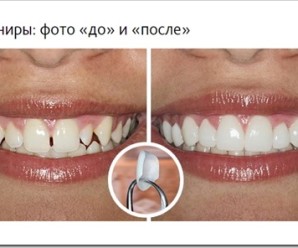 1nto2g4h
